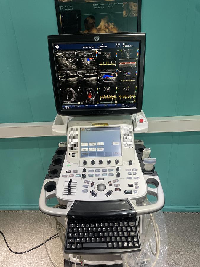 Gebraucht GE Vivid E9 Ultraschallgerät mit zwei Sonden und Drucker