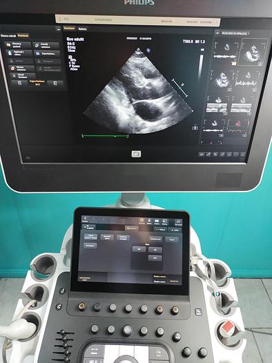 Gebraucht Philips ultrasound Probe S4-2