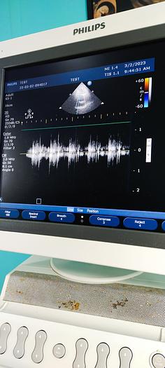 Gebraucht Philips HD11XE Ultraschallgerät mit 3 Sonde