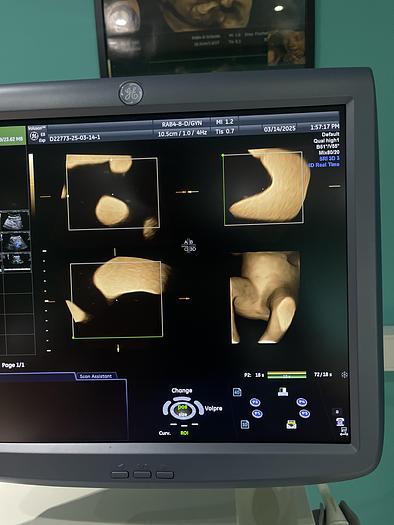 Gebraucht GE 3D/4D RAB4-8-D Ultraschallsonde