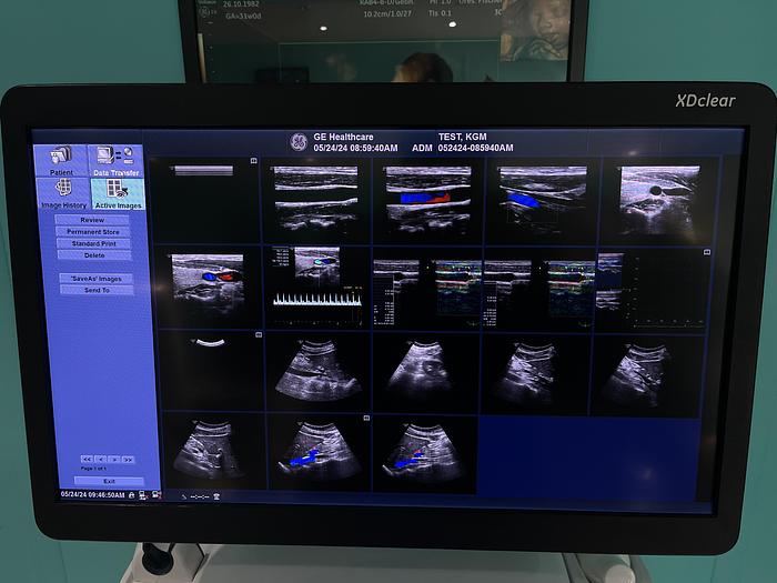 Gebraucht GE LOGIQ E9 XDClear 2.0 SW R6 Ultraschallgerät