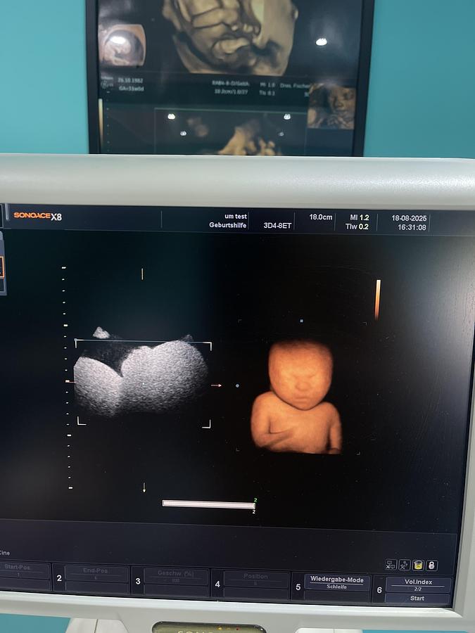 Gebraucht SonoAce X8 Ultraschallgerät mit drei Sonden und Drucker