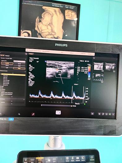 Gebraucht Philips Epiq 5G Flat Screen Ultrasound Scanner