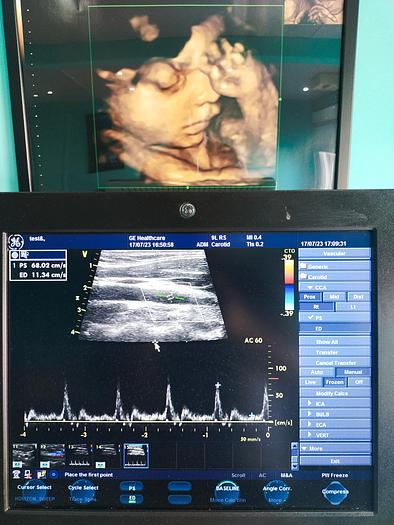 Gebraucht GE Vivid S5 Ultraschallgerät