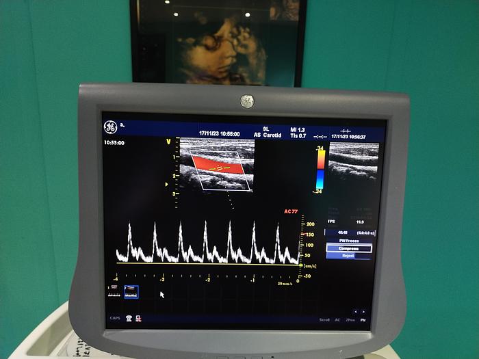 Gebraucht GE Vivid 7 Ultraschallgerät