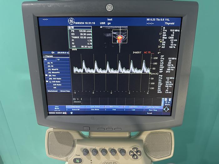 Gebraucht GE Logiq P5 Ultraschallgerät mit drei Sonden und Drucker