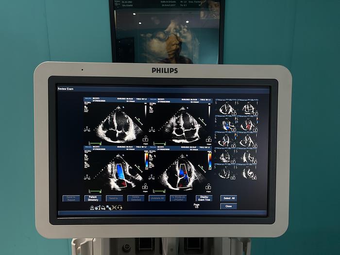 Gebraucht Philips iE33 Ultraschallgerät