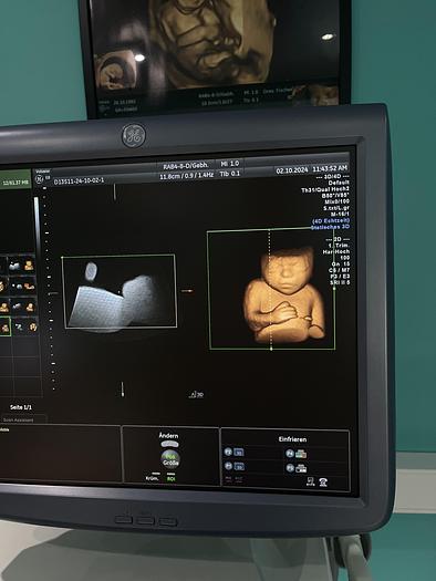 Used GE Voluson E8 Ultraschallgerät mit zwei Sonden und Drucker