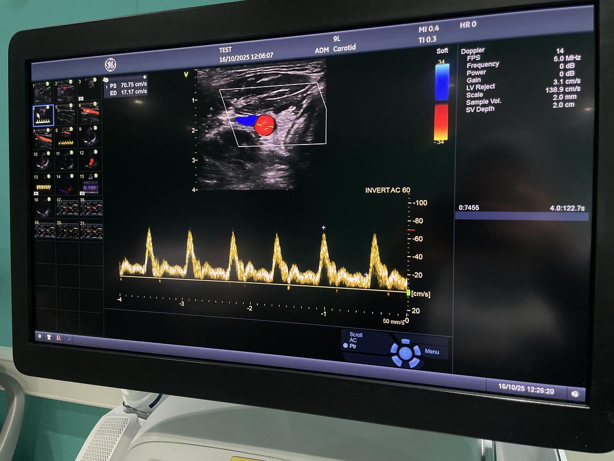 Gebraucht GE Vivid E95 v202 Ultraschallgerät mit zwei Sonden