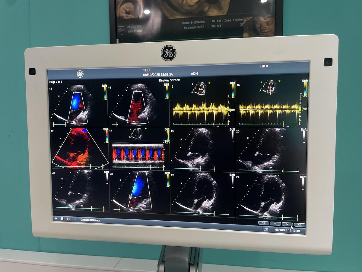 Gebraucht GE Vivid S70 Ultraschallgerät mit zwei Sonden