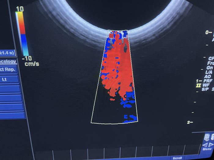 Gebraucht GE E8C Endovaginal Ultraschallsonde 