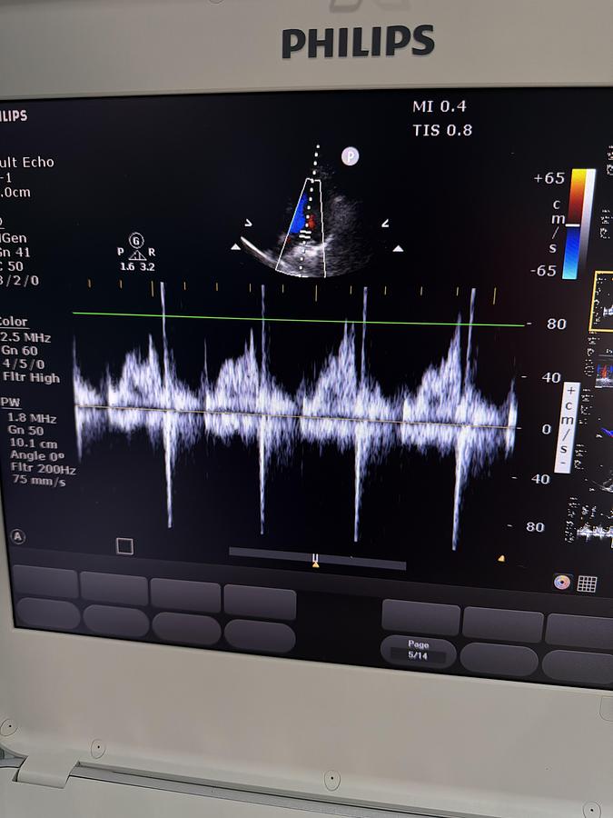 Gebraucht Philips CX50 Ultraschallgerät mit Sonde C.1