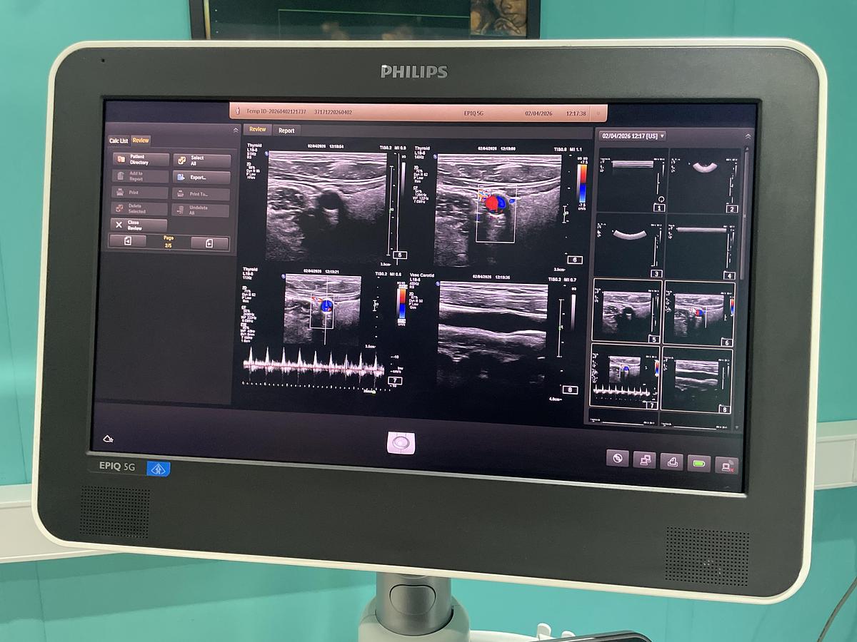 Gebraucht Philips Epiq 5G Ultraschallgerät mit drei Sonden