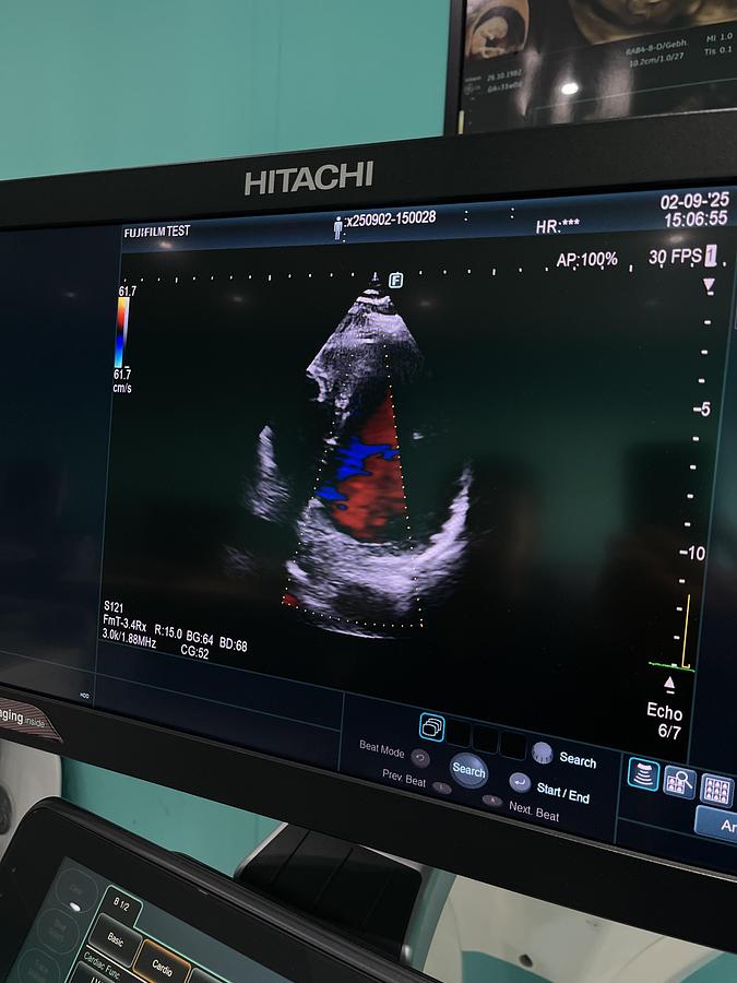 Gebraucht Hitachi ALOKA Arietta 850 Ultraschallgerät mit zwei Sonden und Drucker