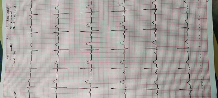 Gebraucht NIHON KOHDEN Cardiofax EKG-Gerät auf Trolley