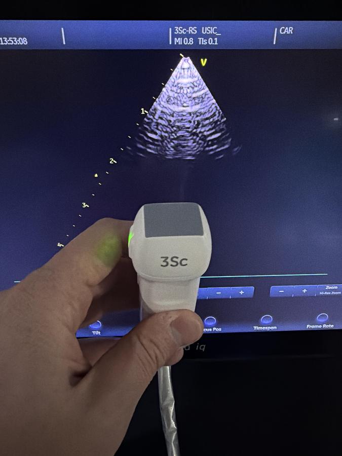 Gebraucht GE 3SC-RS Kardio Ultraschallsonde