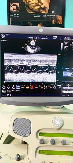 Gebraucht GE Vivid 7 Ultraschallgerät