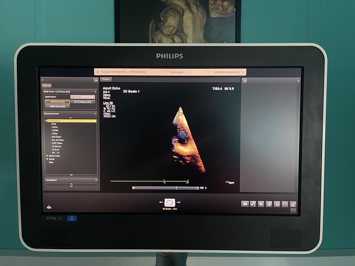 Used Philips EPIQ 5G Ultraschallgerät mit zwei Sonden