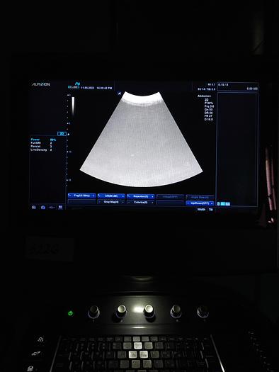 Gebraucht Alpinion E cube 9 Ultraschallgerät SW 2.6 mit 2 Sonde