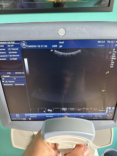 Gebraucht GE Logiq P5 Ultraschallgerät mit drei Sonden und Drucker