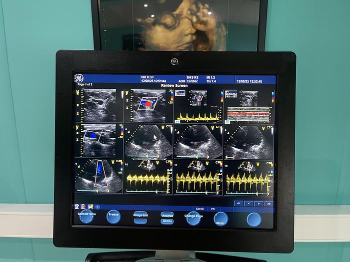 Gebraucht GE Vivid S6 Ultraschallgerät mit zwei Sonden 