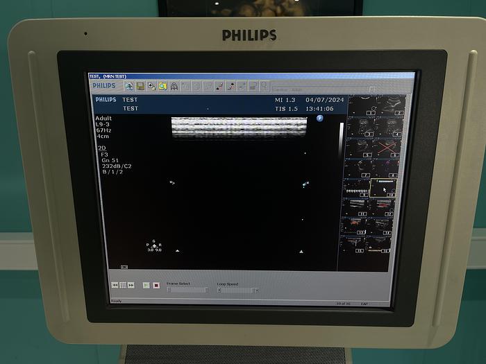 Used Philips HD 11 XE  Ultraschallgerät mit drei Sonden und Drucker