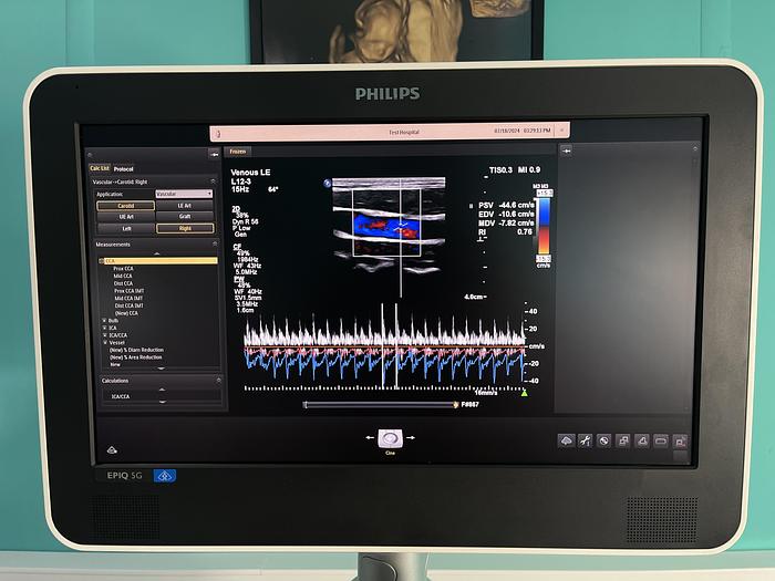 Used Philips EPIQ 5G Ultraschallgerät mit zwei Sonden