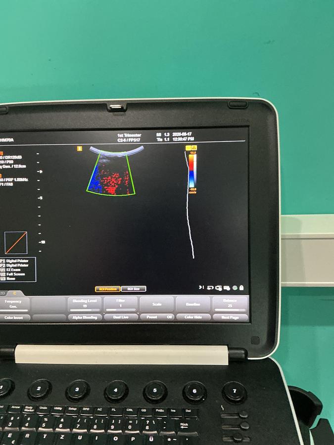 Gebraucht Samsung Medison HM7AF1B Ultraschallgerät mit zwei Sonden