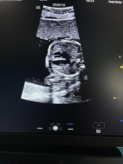 Gebraucht GE Versana Premier Ultraschallgerät mit drei Sonden