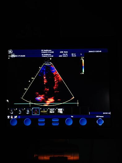 Gebraucht GE  Vivid S5  Ultraschallgerät auf Trolley mit 2 Sonden und EKG Kabel