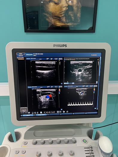 Used Philips HD9 Ultraschallgerät mit drei Sonden