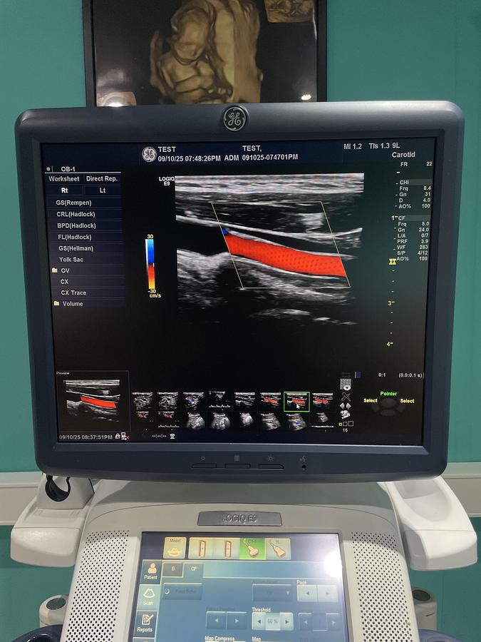 Gebraucht GE LOGIQ E9 Ultraschallgerät mit 2 Sonden und Drucker
