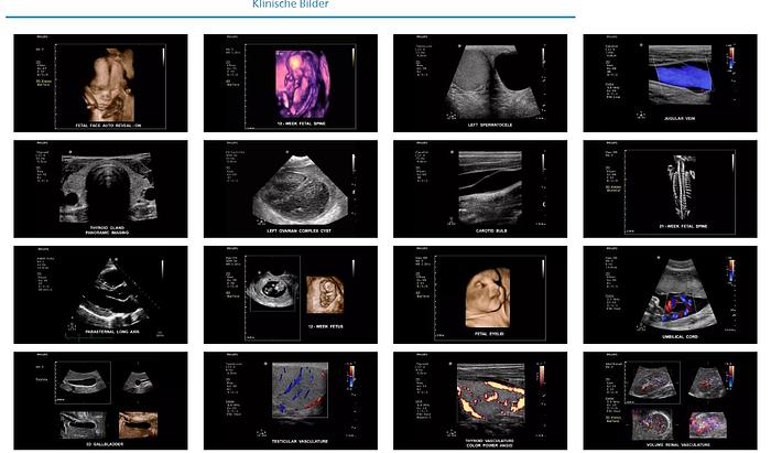 Philips ClearVue 650 Ultraschallsystem