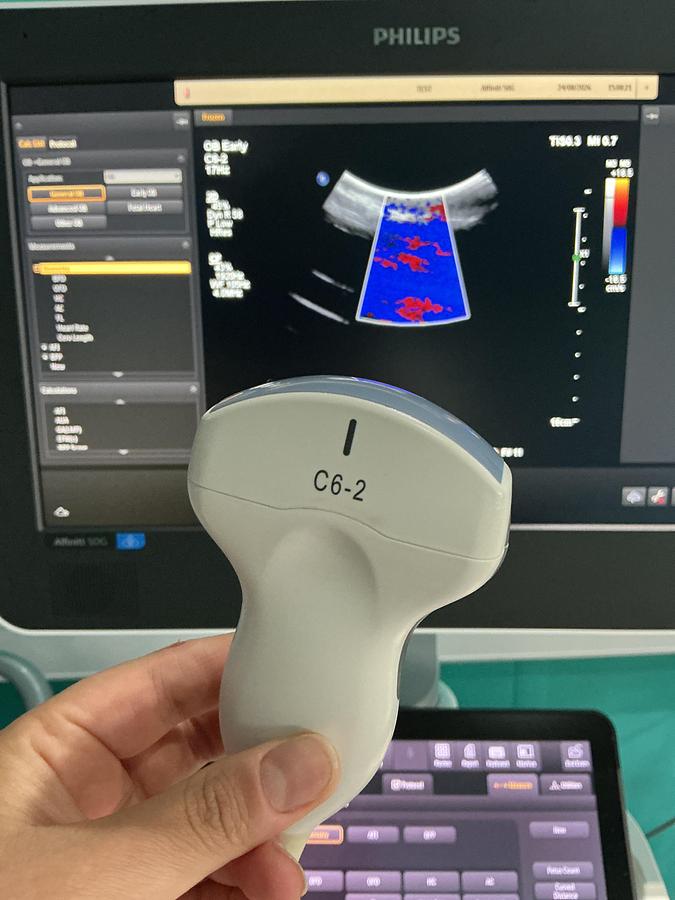 Gebraucht Philips C6-2 Konvex Ultraschallsonde