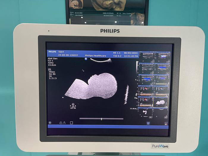 Gebraucht Philips HD15 Ultraschallgerät mit zwei Sonden 