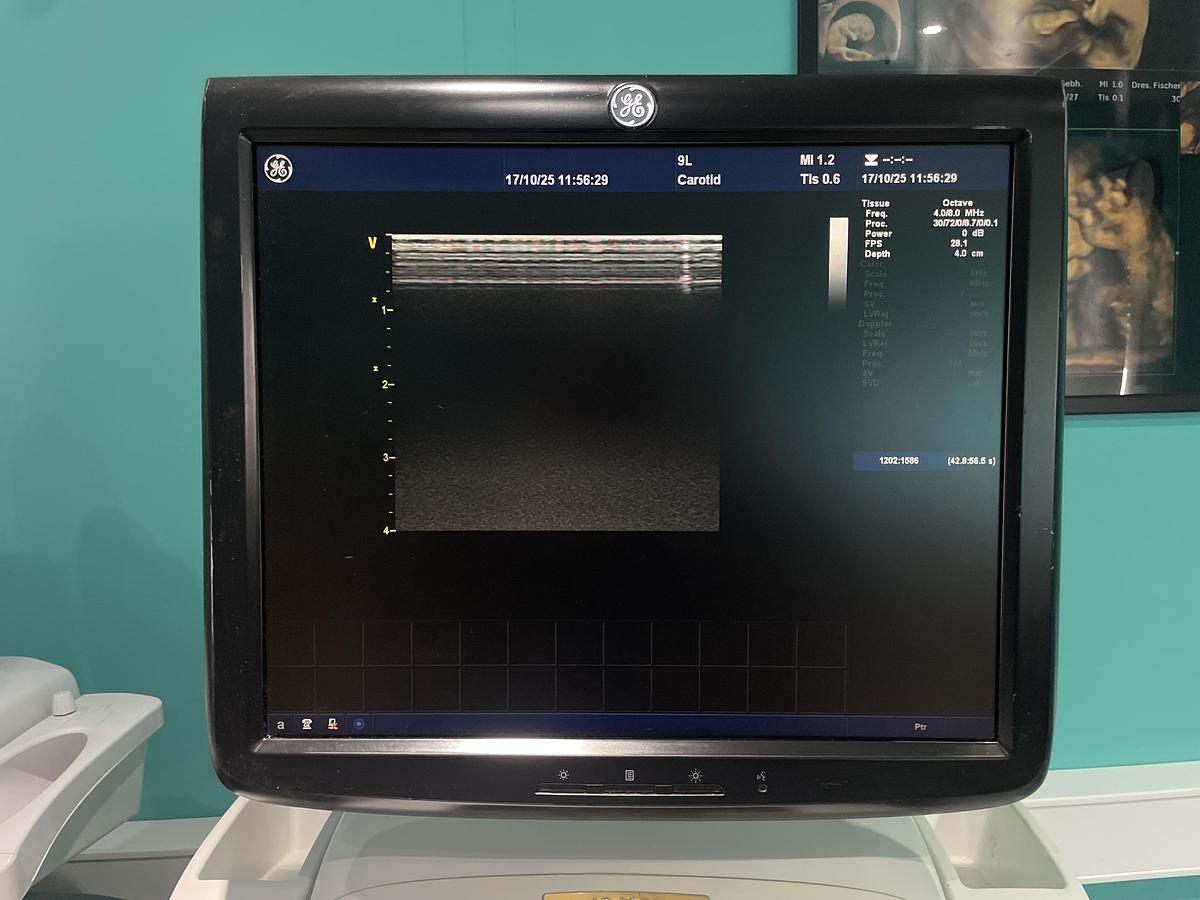 Gebraucht GE 9L-D linear Ultraschallsonde