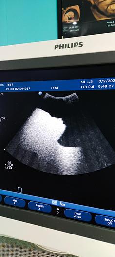 Gebraucht Philips C6-3 Konvex Ultraschallsonde