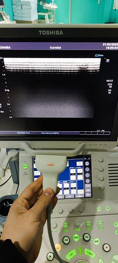 Gebraucht Toshiba aplio XG SSA-790A Ultraschallgerät ohne Sonden