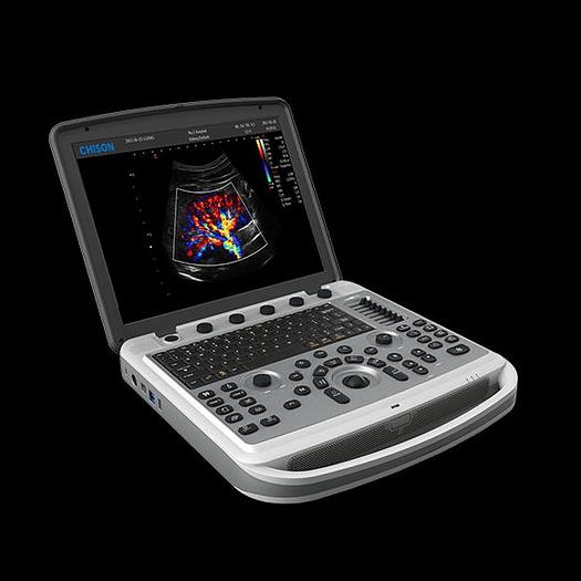 Chison SonoBook 6 tragbares Ultraschallgerät