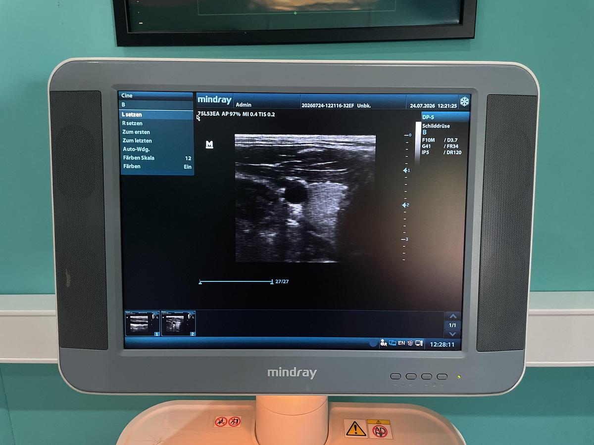 Gebraucht Mindray DP-5 Ultraschallgerät mit zwei Sonden und Drucker