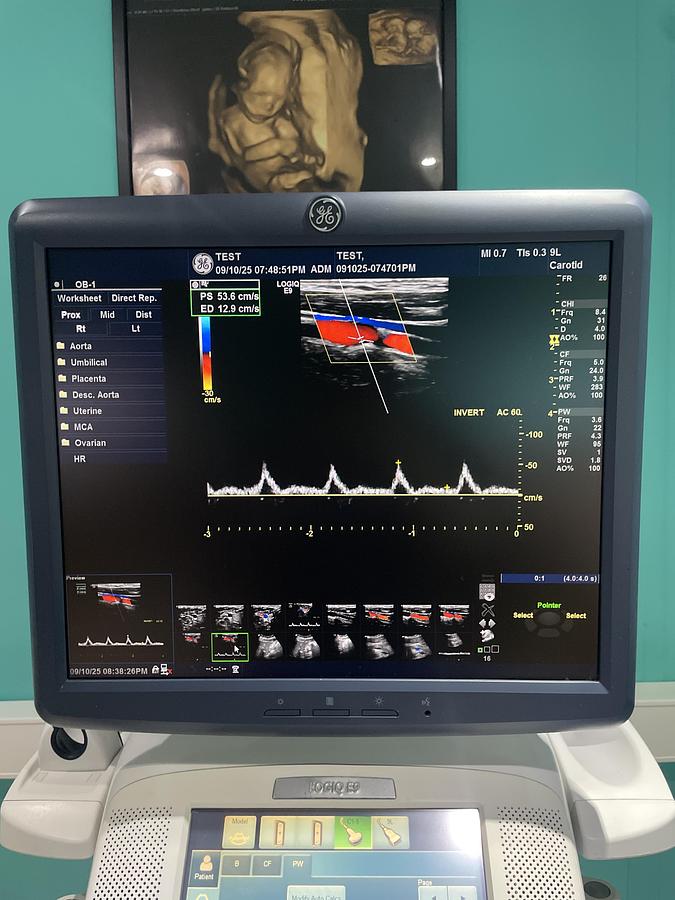 Gebraucht GE LOGIQ E9 Ultraschallgerät mit 2 Sonden und Drucker