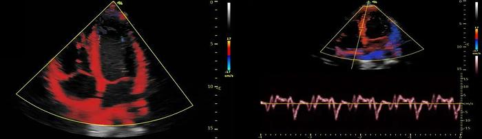 Gebraucht Vinno G55 Ultraschallgerät
