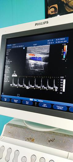 Gebraucht Philips HD11XE Ultraschallgerät mit 3 Sonde