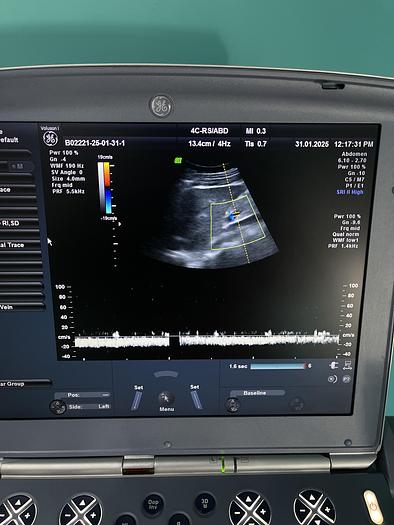 Gebraucht GE Voluson i Ultraschallgerät mit zwei Sonden 