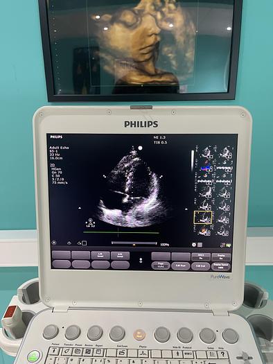 Gebraucht Philips CX50 Ultraschallgerät HW C.0 mit Sektor Sonde