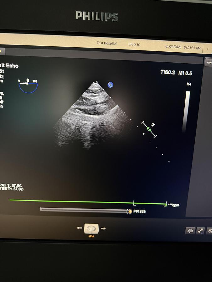 Gebraucht Philips X8-2T compact TEE Ultraschallsonde