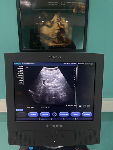 Used Siemens ACUSON X300 Ultraschallgerät mit drei Sonden 
