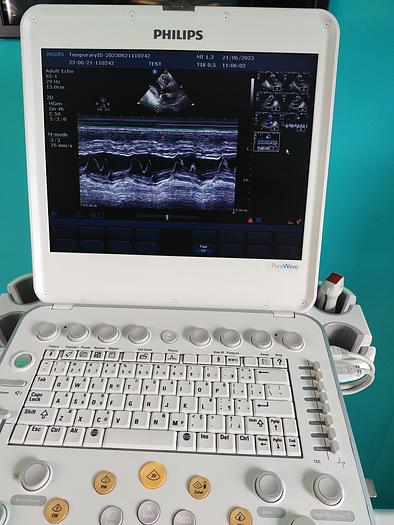 Gebraucht Philips CX50 Flat Screen Ultrasound Scanner
