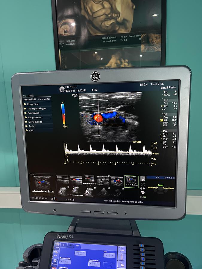 Used GE LOGIQ S8 Ultraschallgerät mit M5S-D kardio Ultraschallsonde und Drucker