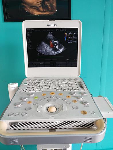 Gebraucht Philips CX50 Flat Screen Ultrasound Scanner